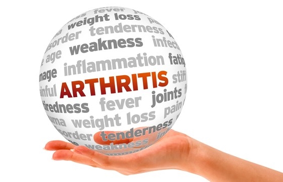 Penyakit Radang Sendi - Arthritis