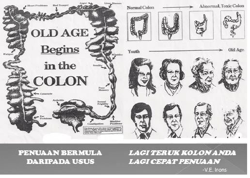 Khasiat Aloe Vera Gel Jus Lidah Buaya