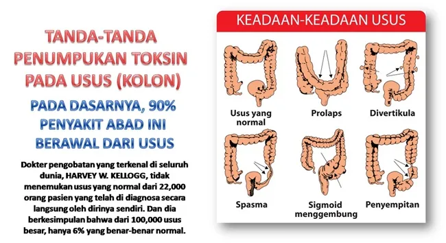 Khasiat Aloe Vera Forever Living