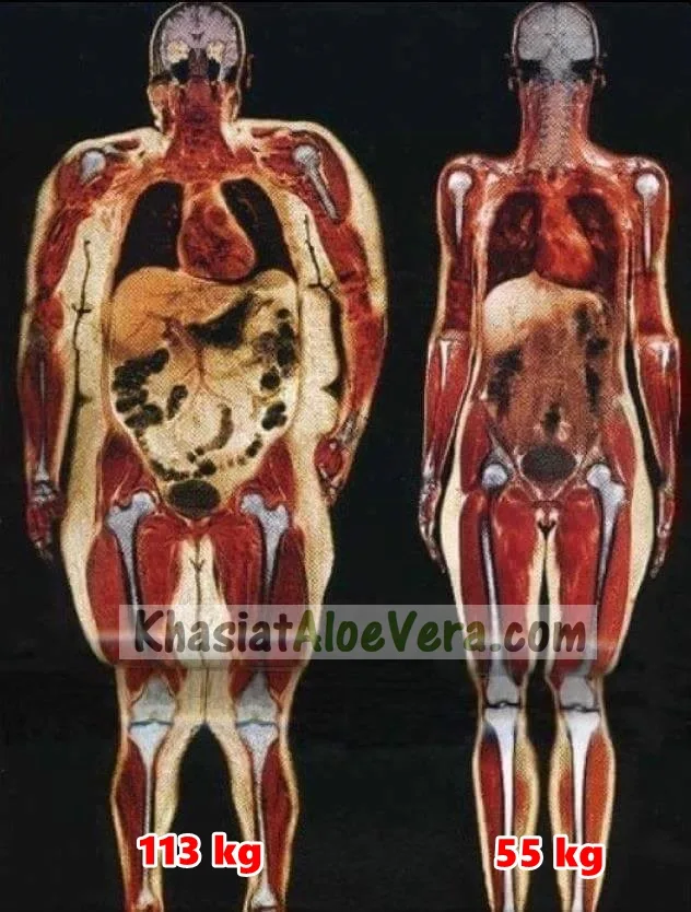 Khasiat Aloe Vera Forever Living Products Malaysia